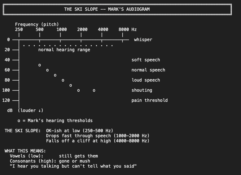 chart of hearing slope